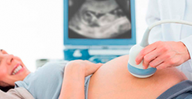 foto que muestra una ecografia a una mujer embarazada